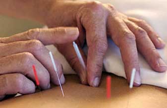 Aizawa Acupuntura - Foto 1