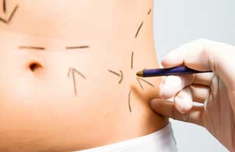 Murillo Caldeira - Foto 1