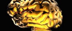 neurologia-campo-belo-1387300019